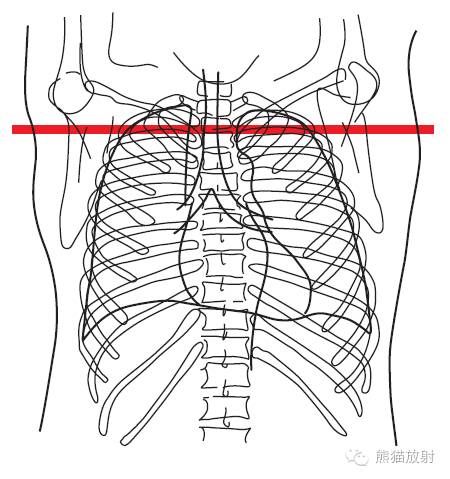 Chest Anatomy | Chest CT Cross-Sectional Anatomy
