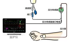 Clinical Applications of Pressure Sensors