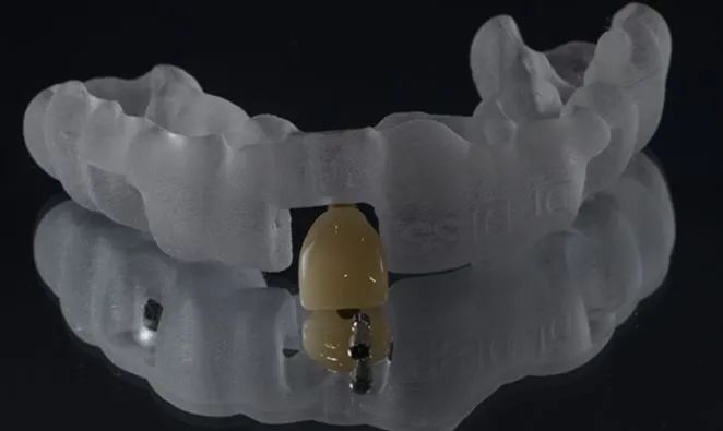 Overview: Eight Major Applications of 3D Printing in Dentistry