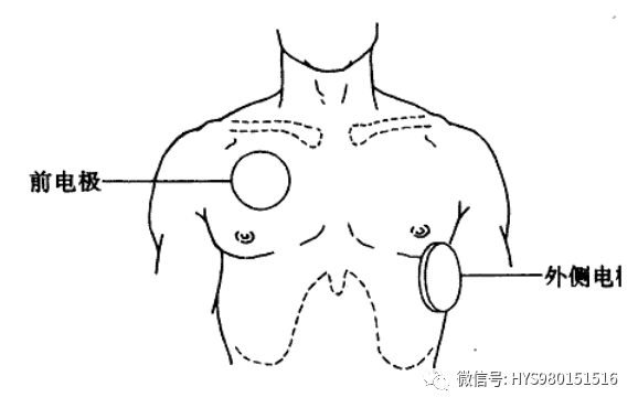 How to Use a Defibrillator: Operation Procedures