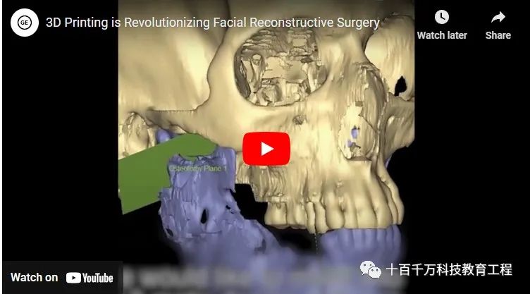 5 Major Applications of 3D Printing Technology in Healthcare