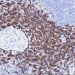Understanding IHC, ICC, and IF: Clearing Up Common Confusions