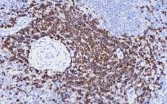Understanding IHC, ICC, and IF: Clearing Up Common Confusions