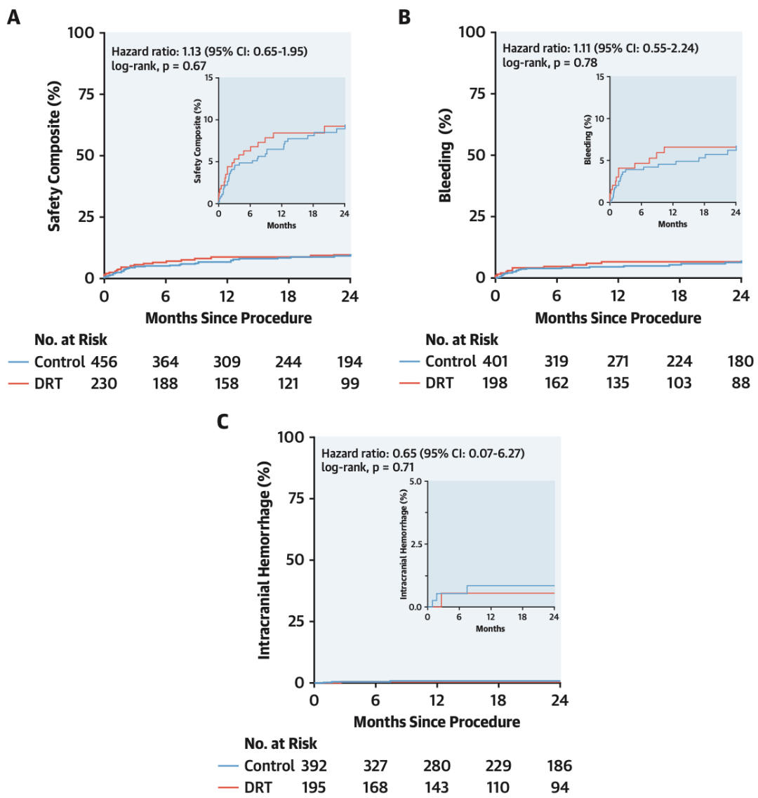 Predictive Factors of DRT After LAAO: International Multicenter Data