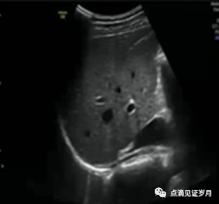 Understanding and Adjusting Parameters of Color Doppler Ultrasound Machines