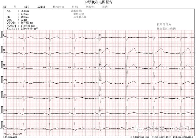 Six Common Causes of ECG Diagnostic Errors and Countermeasures