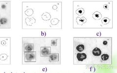 Digital Image Processing: Edge Detection