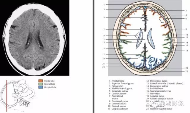 The Most Comprehensive CT Cross-Sectional Anatomy Atlas