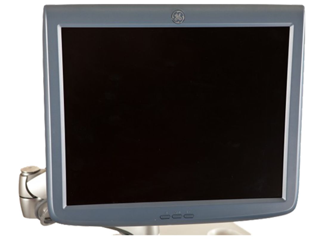 Basic Structure and Repair Examples of Ultrasound Diagnostic Equipment