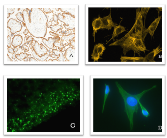 Understanding IHC, ICC, and IF: Clearing Up Common Confusions