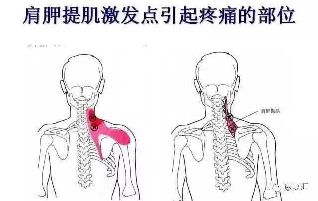 Detailed Guide to Shoulder Joint Physical Examination for Rehabilitation