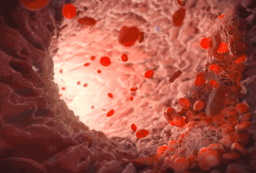 Vitamin C: The Key to Preventing Arterial Blockage