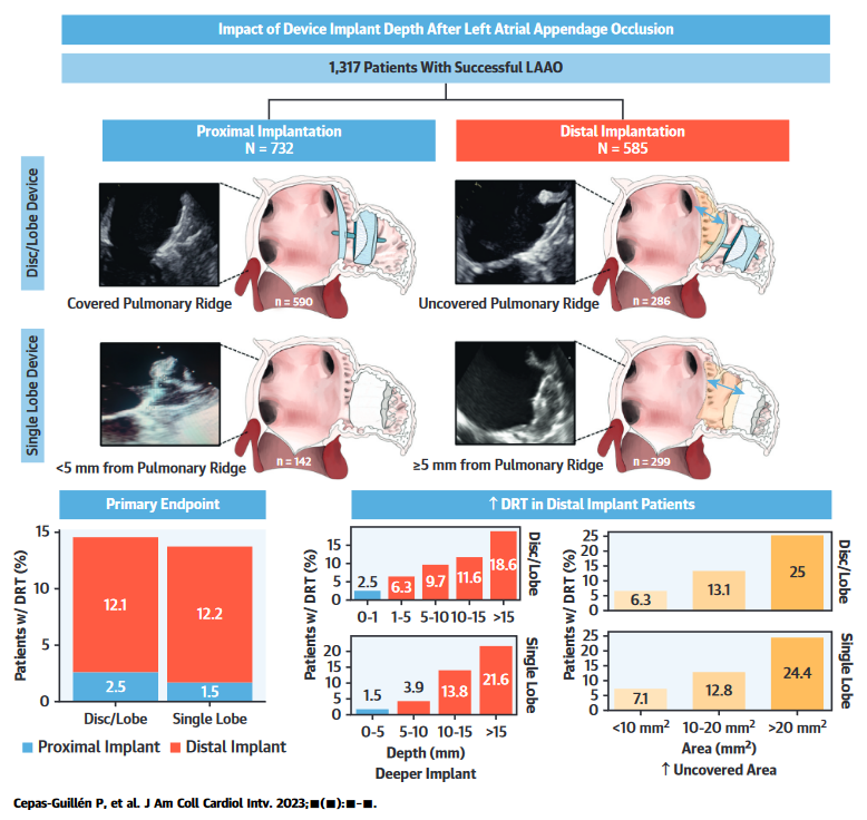 Impact of Left Atrial Appendage Occlusion Device Implant Depth on Thrombus Formation