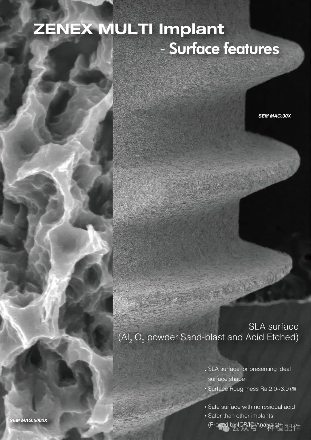 IZEN Zenex Multi I-system Implant Manual