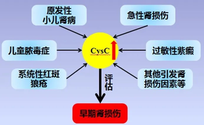 Cystatin C: An Important Indicator of Kidney Function
