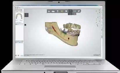 Revealing the Secrets of 3D Printing Technology in Dentistry