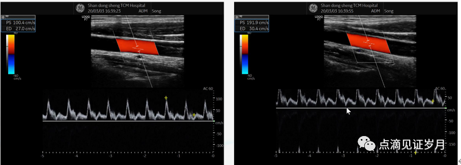 Understanding and Adjusting Parameters of Color Doppler Ultrasound Machines