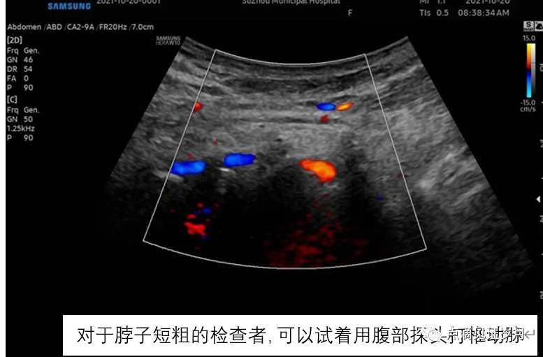 Understanding and Adjusting Parameters of Color Doppler Ultrasound Machines