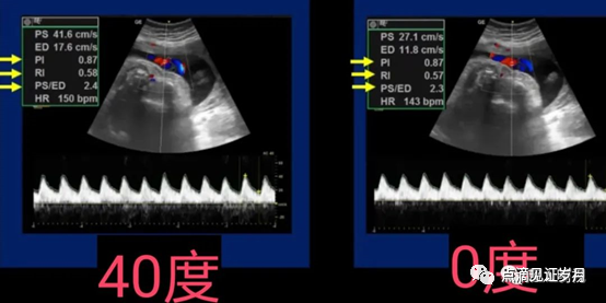 Understanding and Adjusting Parameters of Color Doppler Ultrasound Machines