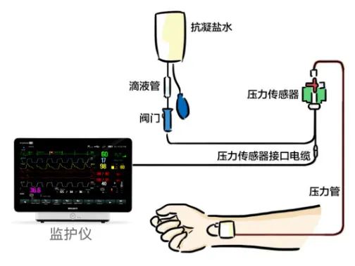 Clinical Applications of Pressure Sensors