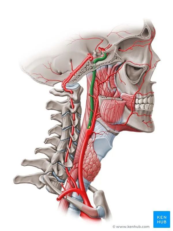 Mastering Clinical Treatment of Internal Carotid Artery Occlusion (ICAO)