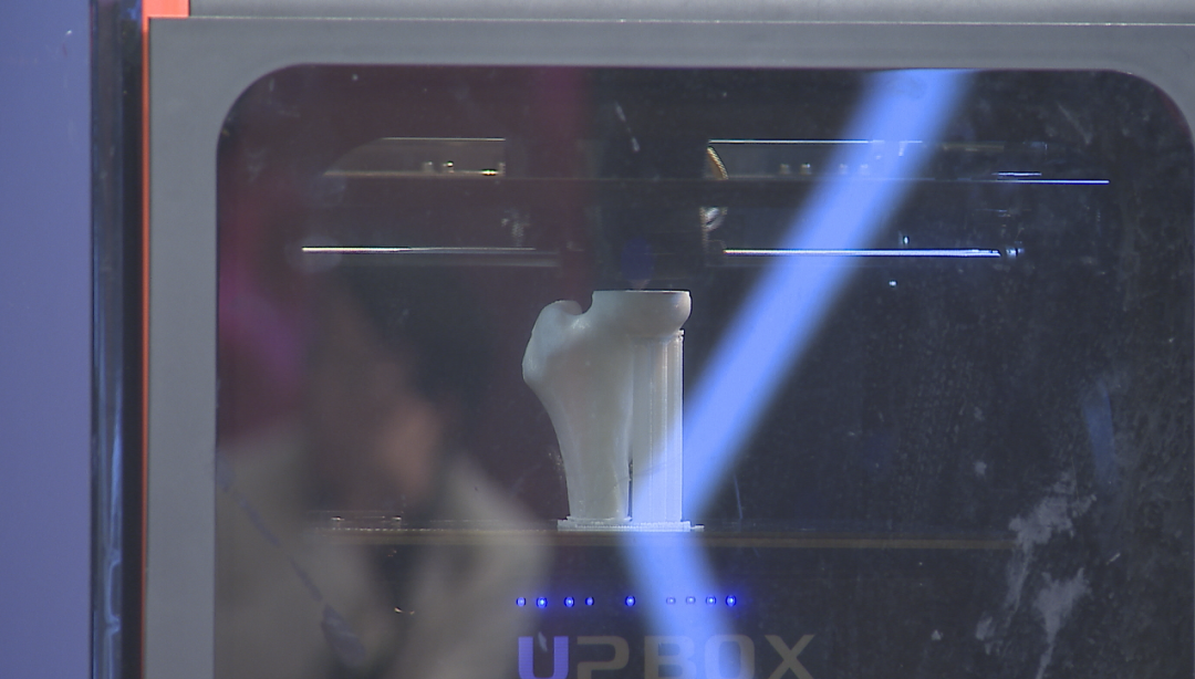 3D Printing: Regenerating Bones