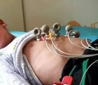 Analysis and Countermeasures for Common ECG Diagnosis Errors