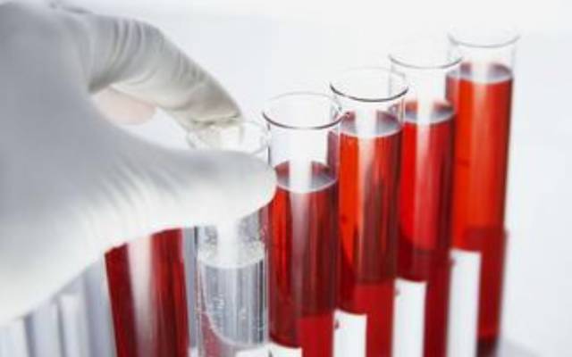 Significance and Normal Values of C-Peptide Release Test