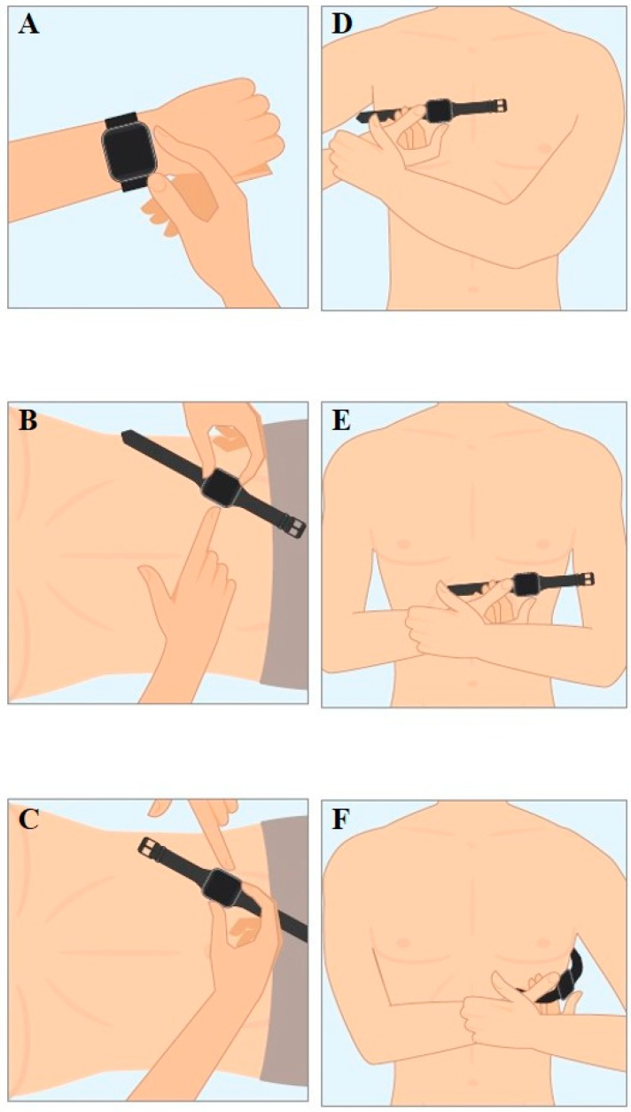 Mastering Smartwatches: Transforming Into An ECG Machine