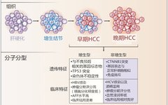 Pathological Diagnosis, Staging, and Classification of Liver Cancer