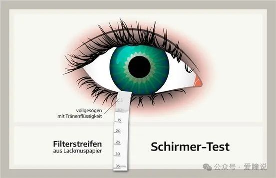 Dry Eye Clinical Examination and Diagnostic Instruments (Part 1)