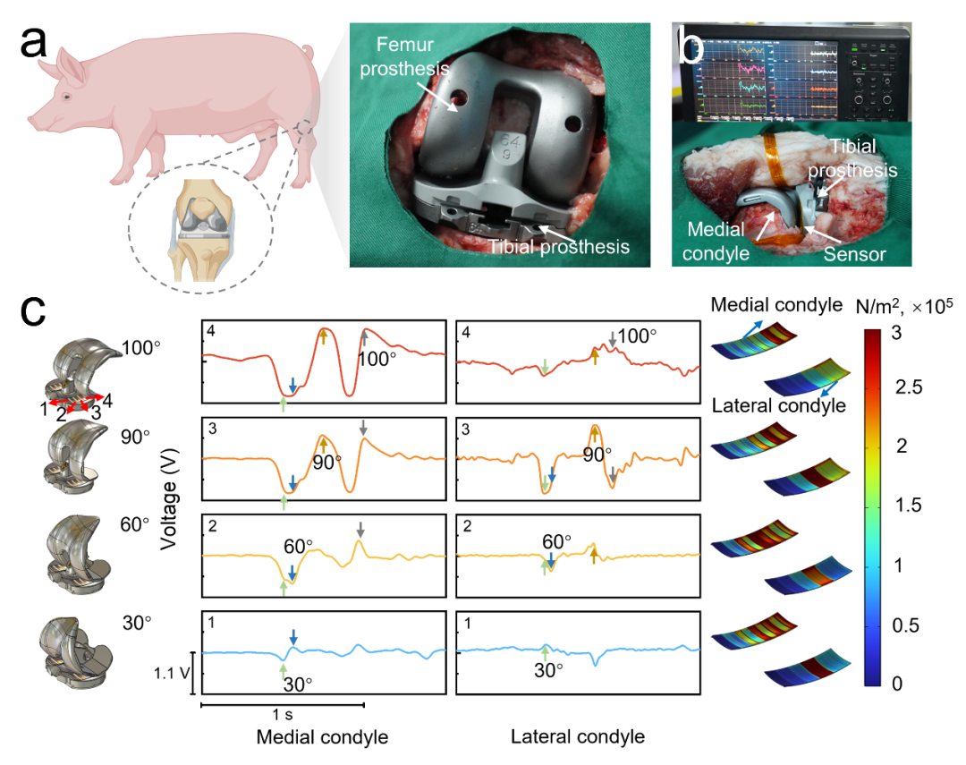AFM: Breakthrough in Dynamic Pressure Monitoring with Self-Powered Flexible Sensor Arrays