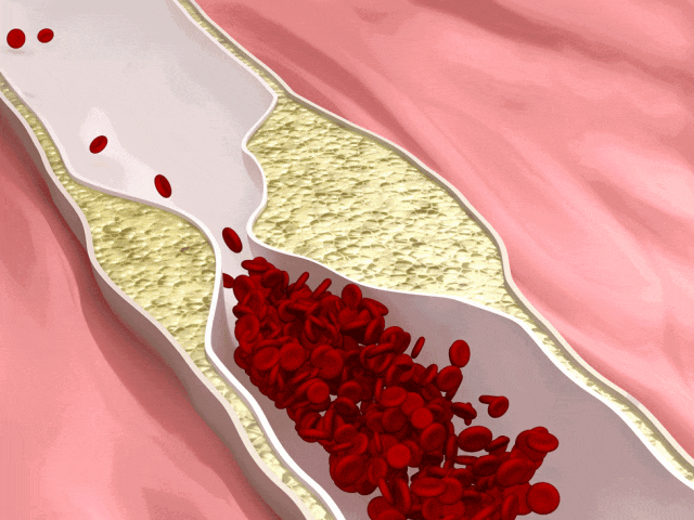 Vitamin C: The Key to Preventing Arterial Blockage
