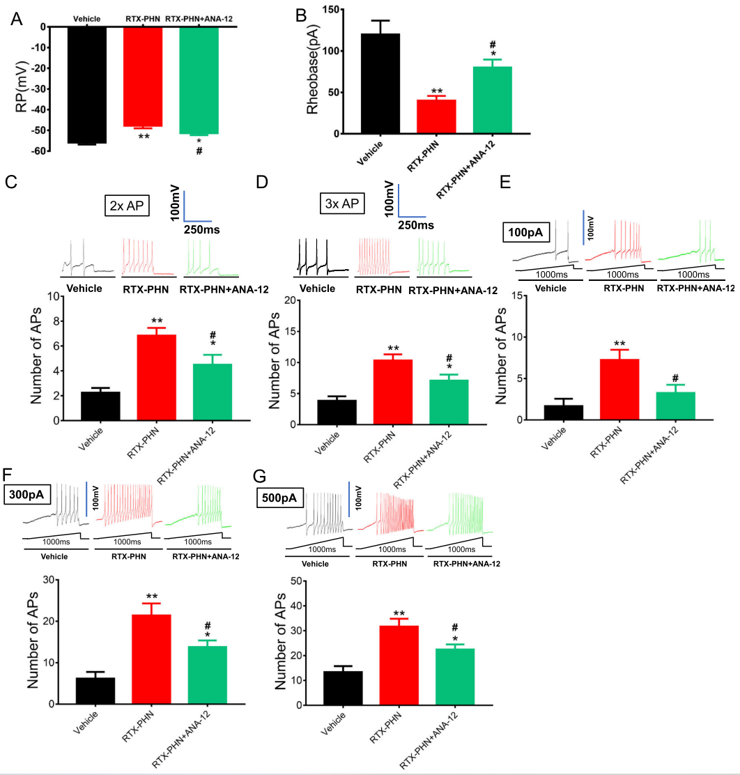 Inhibiting BDNF/TrkB.T1 Receptor Alleviates Postherpetic Neuralgia