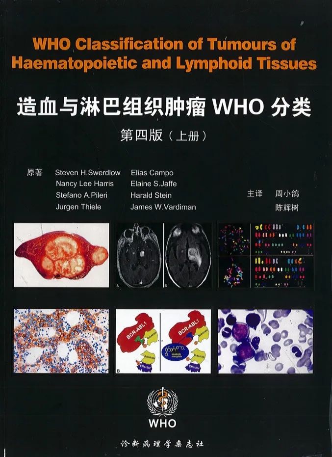 Introduction to International Consensus Classification of Hematolymphoid Tumors