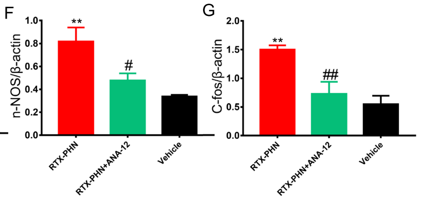 Inhibiting BDNF/TrkB.T1 Receptor Alleviates Postherpetic Neuralgia