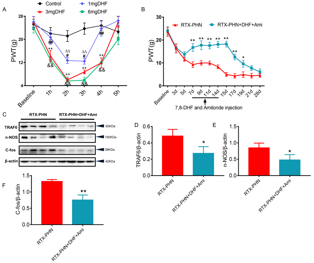Inhibiting BDNF/TrkB.T1 Receptor Alleviates Postherpetic Neuralgia