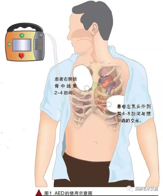 How to Use a Defibrillator: Operation Procedures