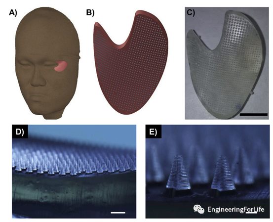 Applications of Projection Photopolymerization in 3D Bioprinting: Microneedles, Microspheres, and Microfluidic Chips