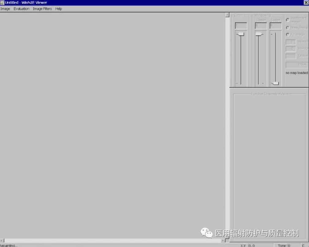 Siemens DR Preprocessing Image Retrieval (Part 1)