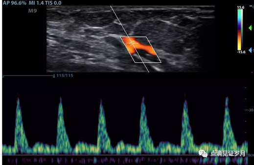 Understanding and Adjusting Parameters of Color Doppler Ultrasound Machines