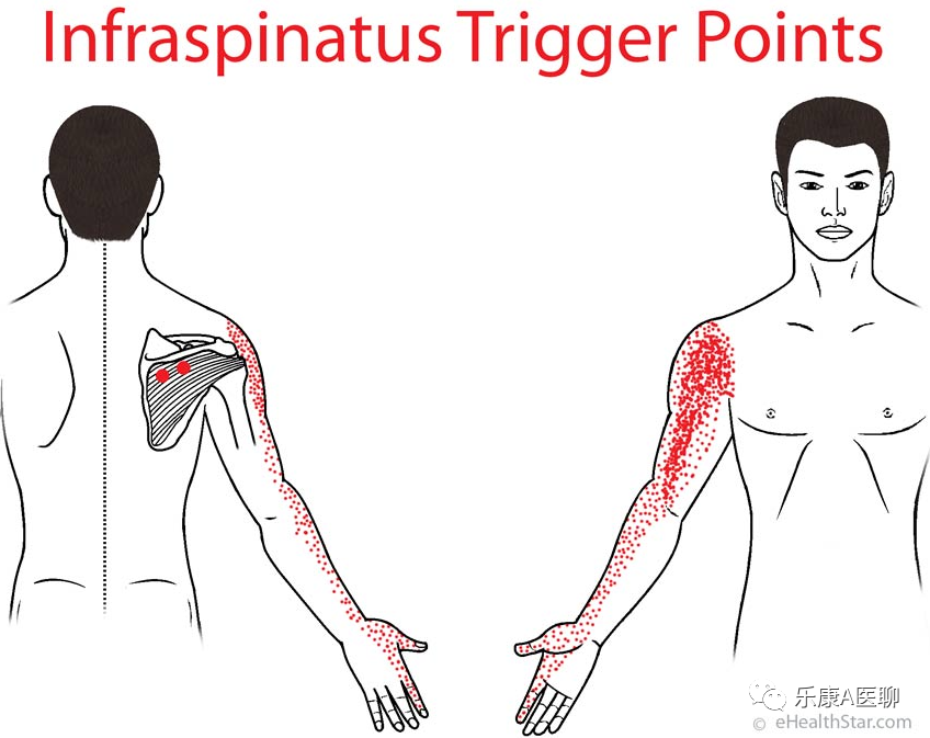 What We Should Know About the Infraspinatus Muscle