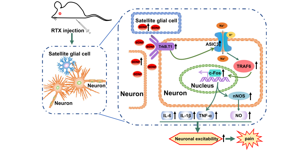 Inhibiting BDNF/TrkB.T1 Receptor Alleviates Postherpetic Neuralgia