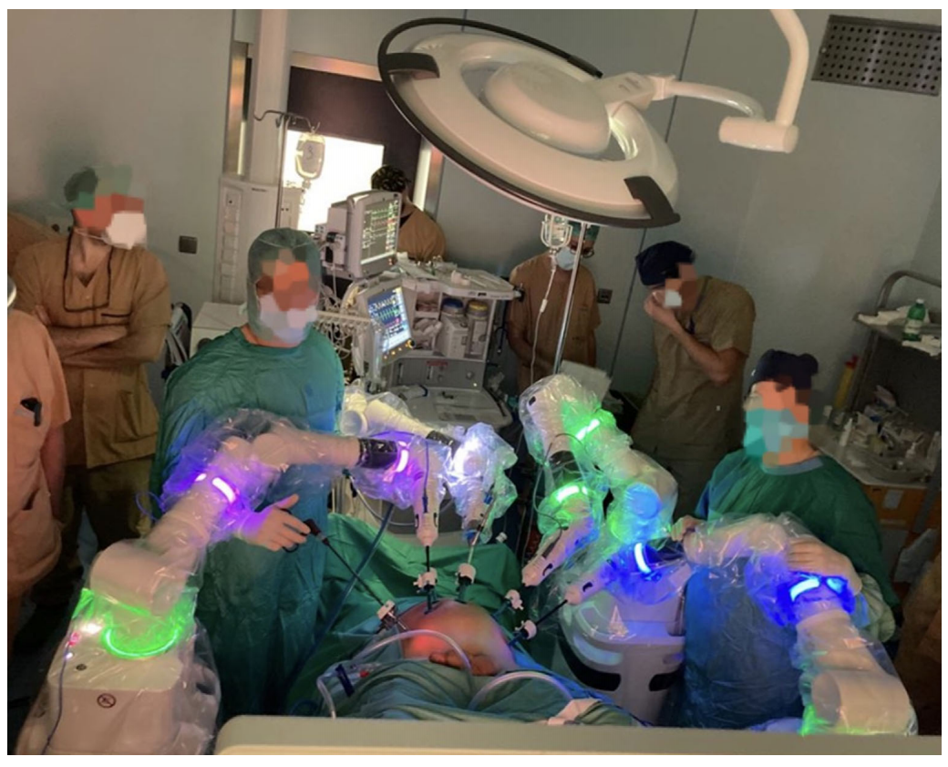 Understanding Robotic Surgery: Innovations and Insights
