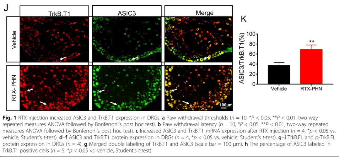 Inhibiting BDNF/TrkB.T1 Receptor Alleviates Postherpetic Neuralgia