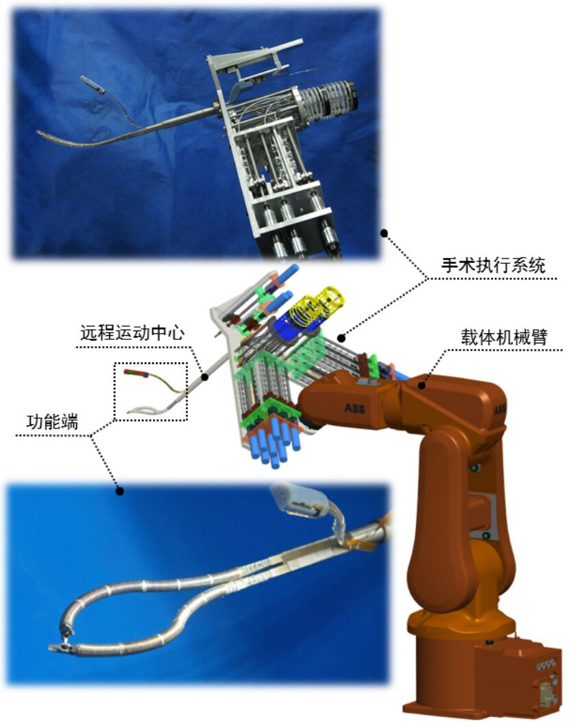 Overview of Domestic Surgical Robots in China