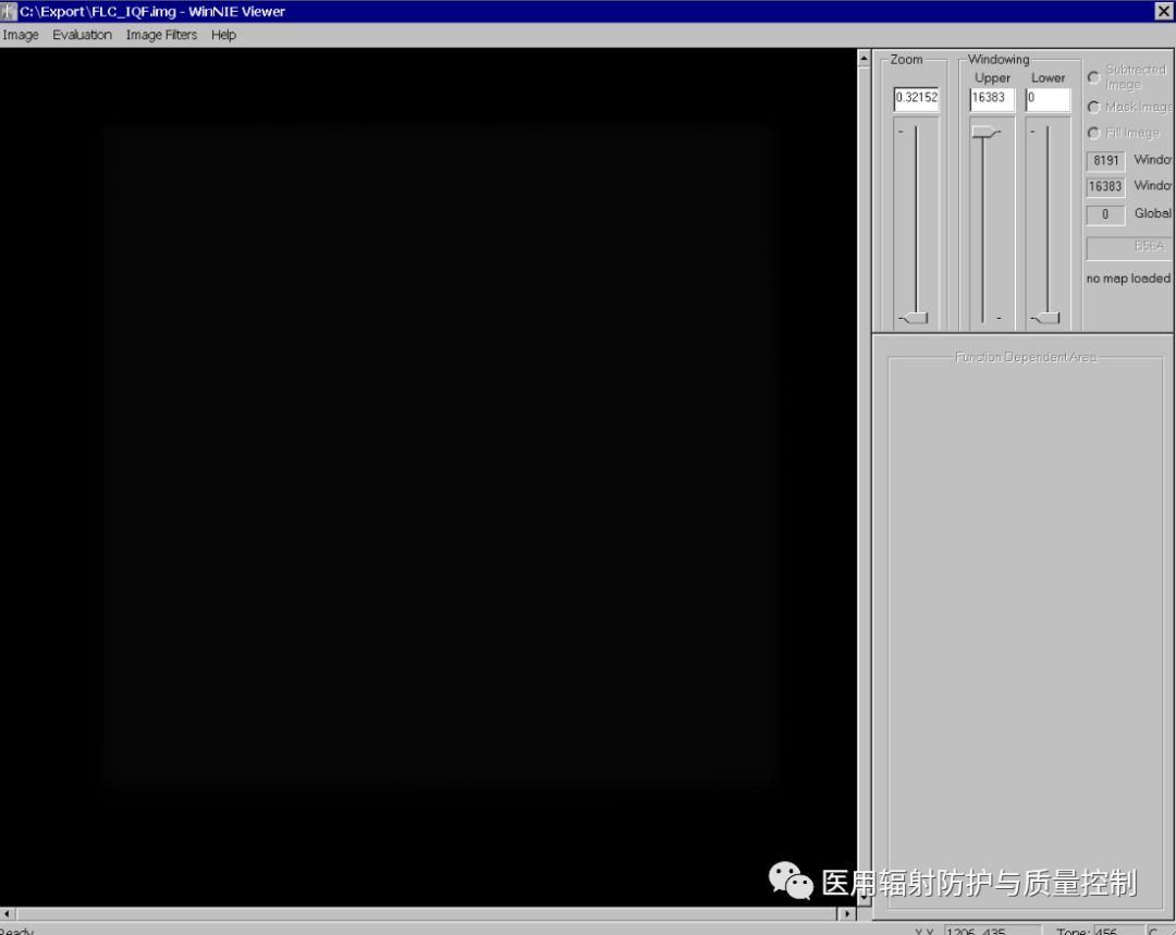 Siemens DR Preprocessing Image Retrieval (Part 1)