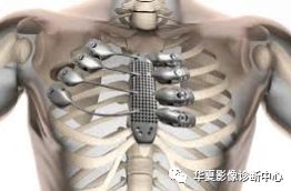 Understanding Medical 3D Printing and Its Applications