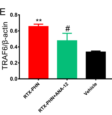 Inhibiting BDNF/TrkB.T1 Receptor Alleviates Postherpetic Neuralgia