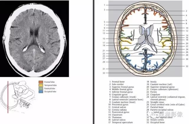 The Most Comprehensive CT Cross-Sectional Anatomy Atlas